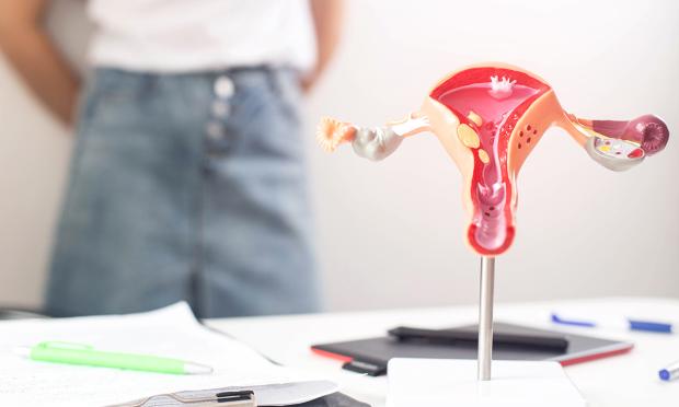 Summary of the 2023 international evidence‐based guideline for the assessment and management of polycystic ovary s